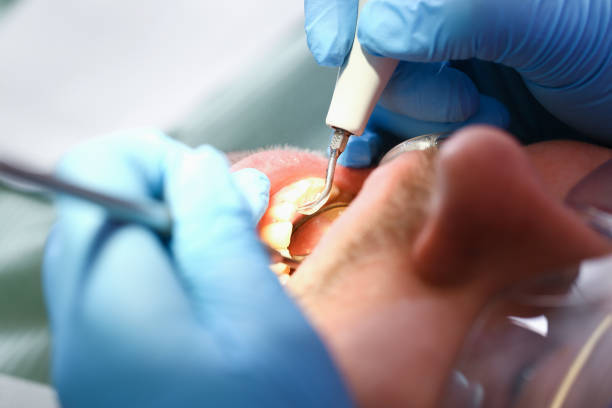 Best Weekend Emergency Dentist in Old River Winfree, TX