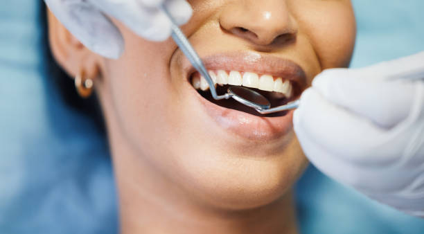 Best Emergency Dental Care for Abscessed Tooth in Old River Winfree, TX