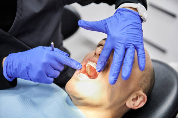 Best Emergency Dentist for Knocked-Out Tooth in Old River Winfree, TX